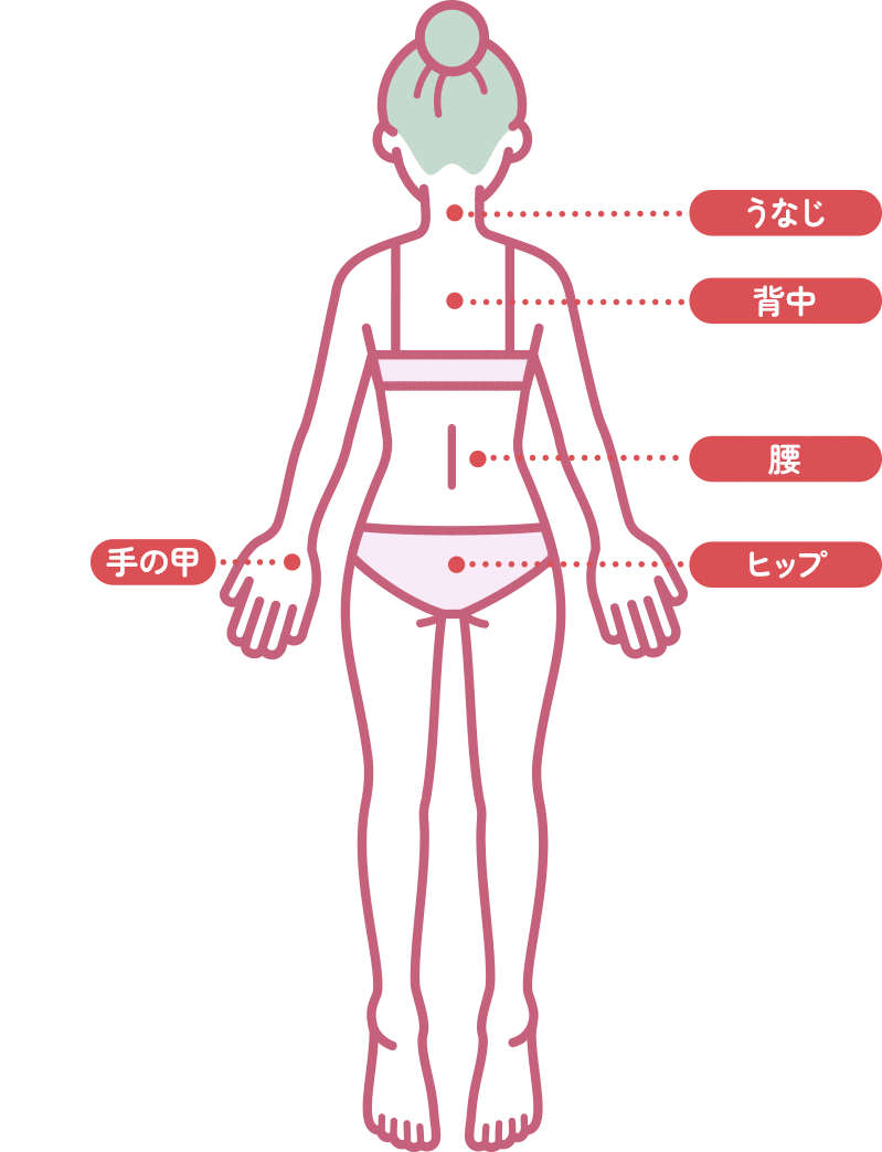 レディース脱毛部位（後）