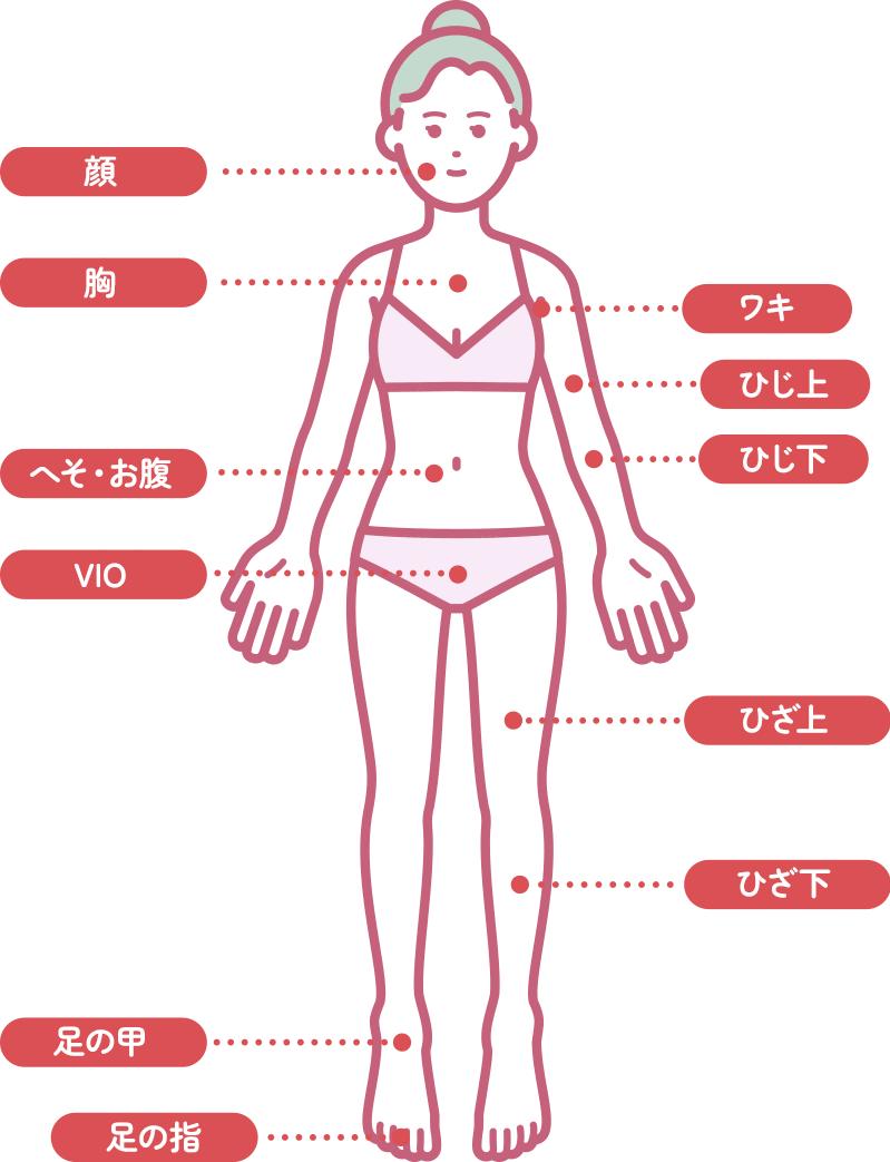 レディース脱毛部位（前）