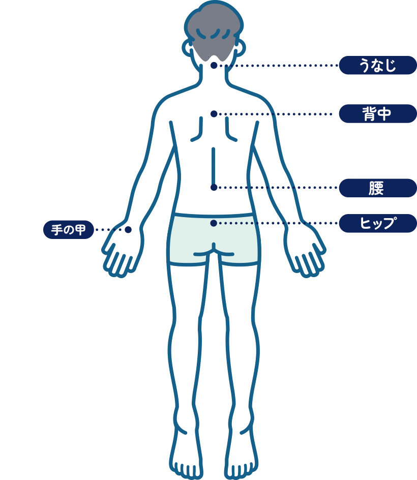 メンズ脱毛部位（後）